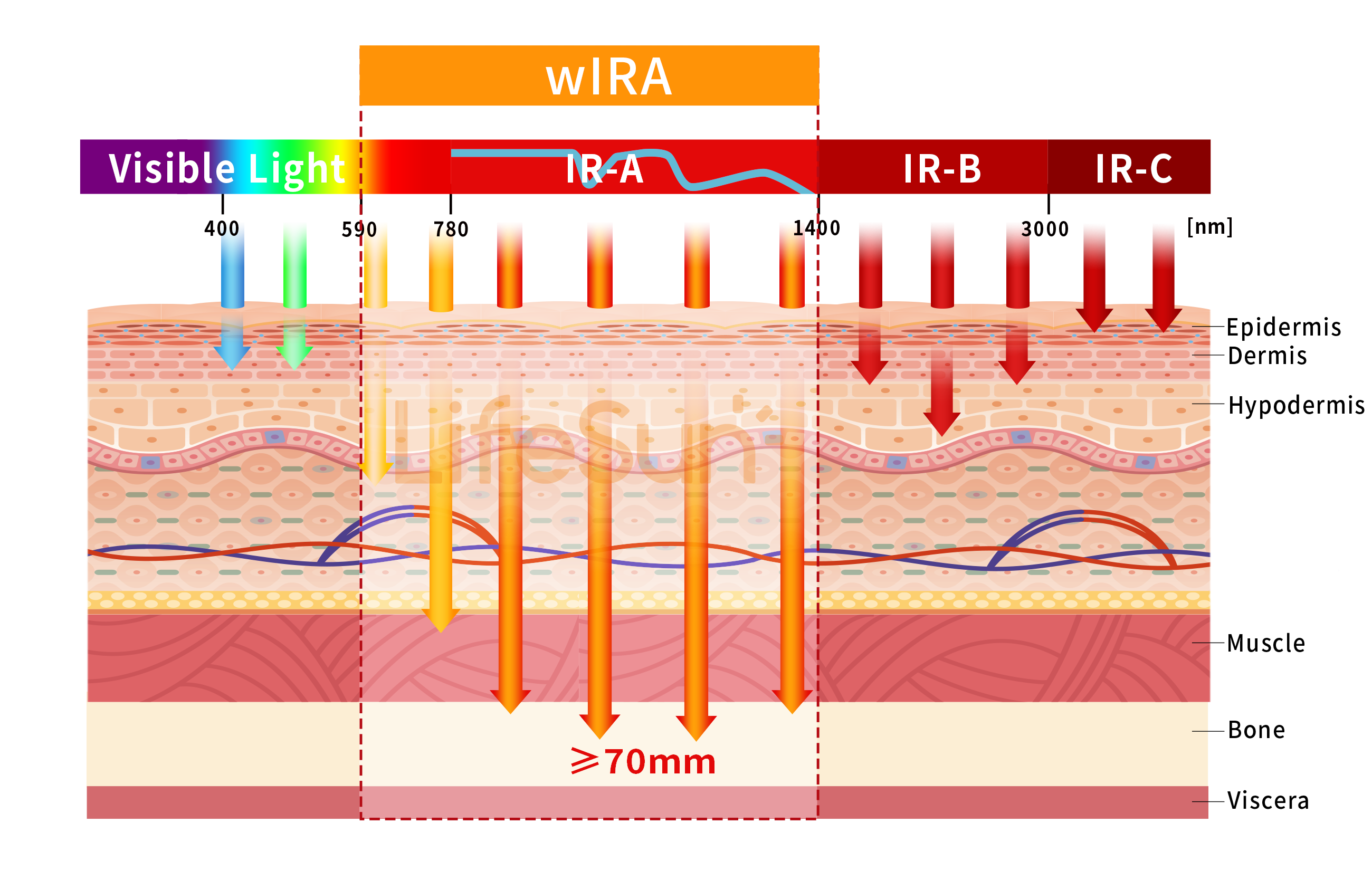 wIRA