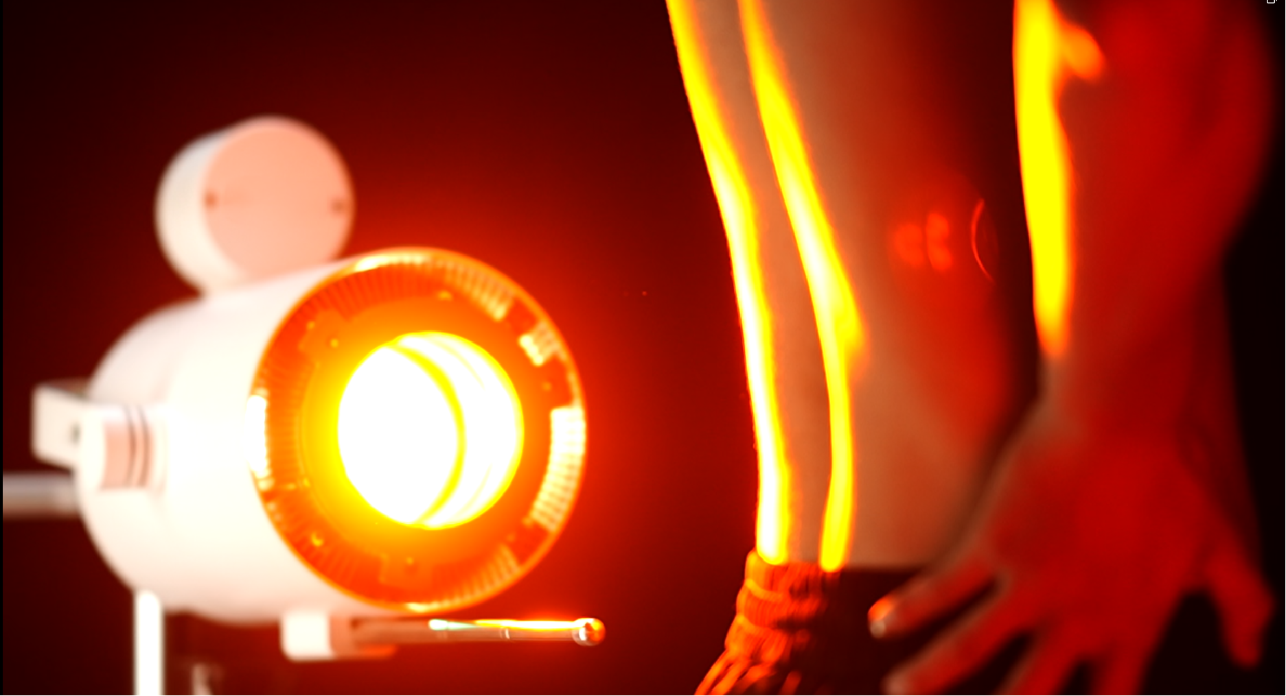 High-Energy Infrared Therapy Device